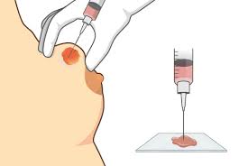 Cytology